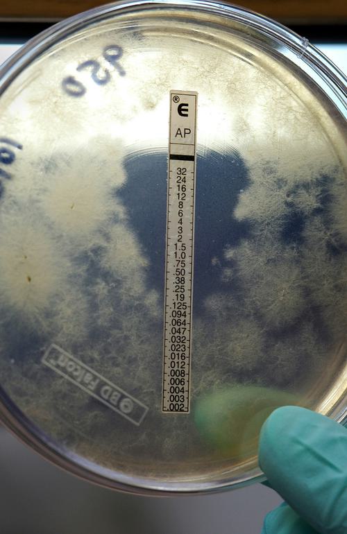 Schimmeltest l Dijkhuis Bouwbiologische aannemer